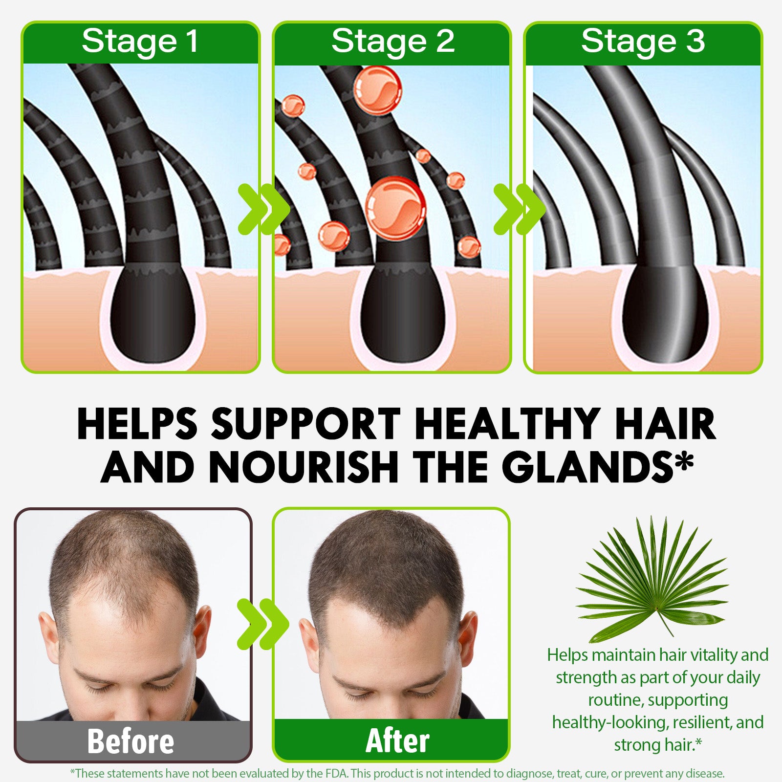 acentiallabs SAW PALMETTO 4000 MG Equivalent per serving 300 SOFTGELS Bagged Capsules