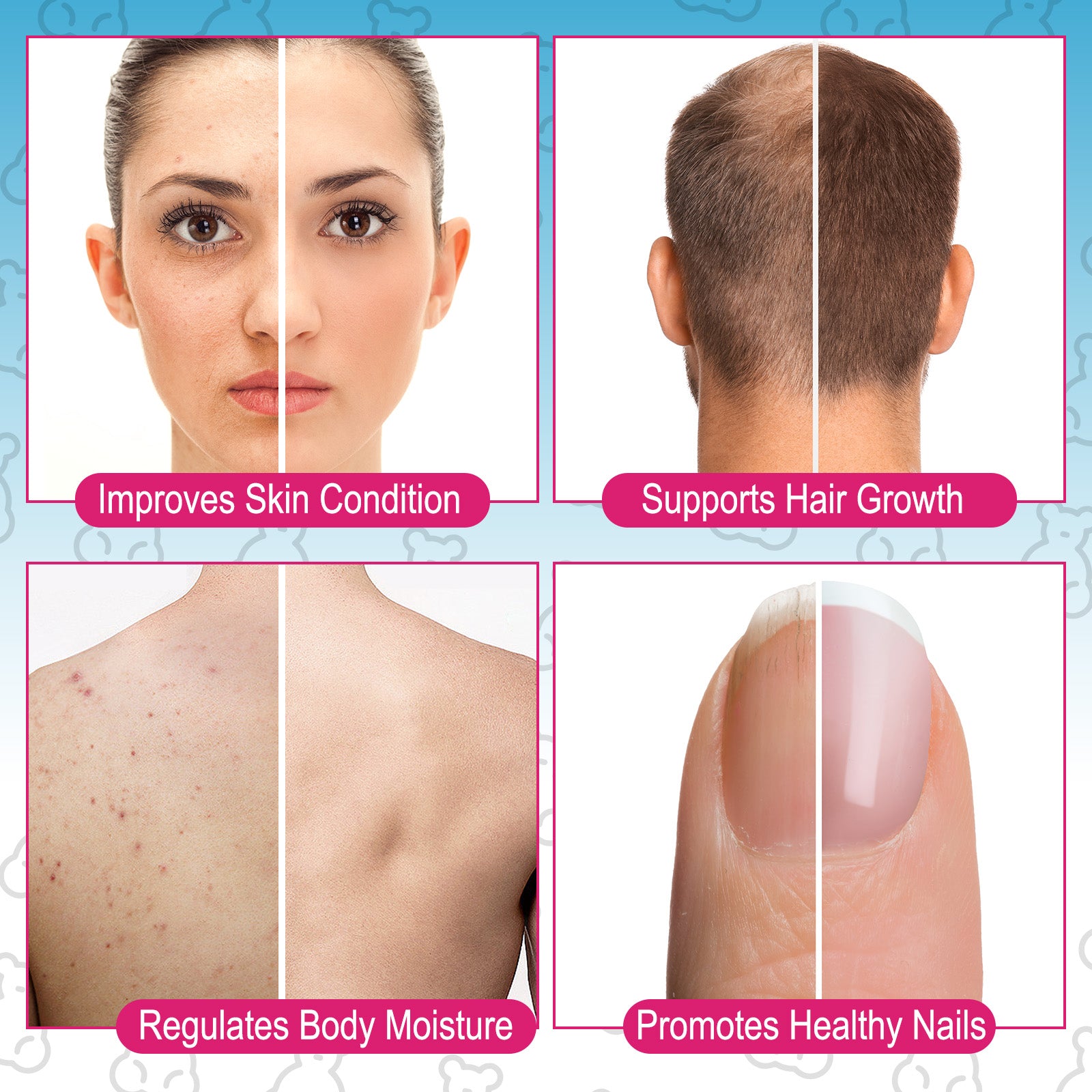 acentiallabs QUERCETIN with Bromelain,+ ZINC + VITAMIN C+ VITAMIN D3,120 VEGGIE CAPSULES Bottled Capsules