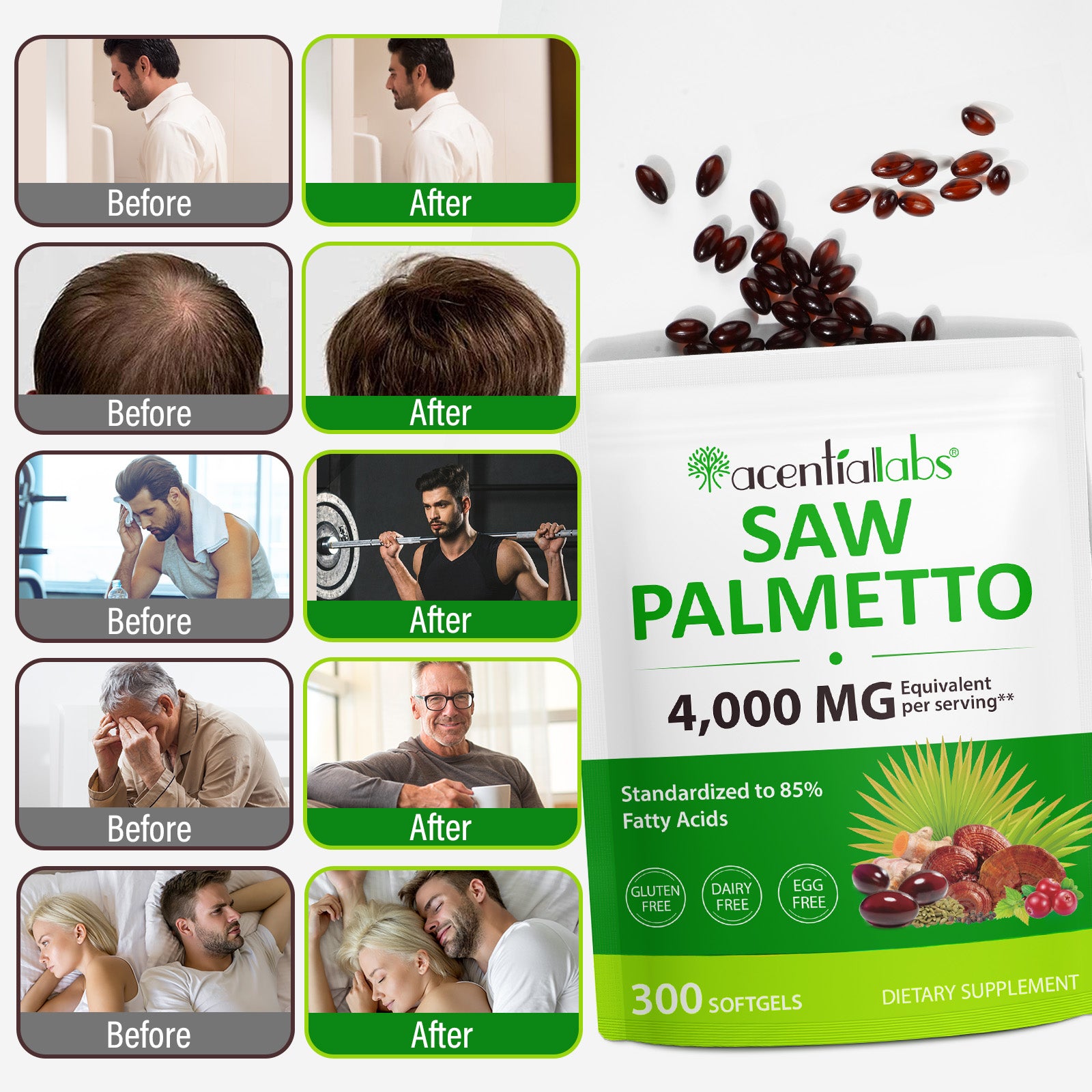 acentiallabs SAW PALMETTO 4000 MG Equivalent per serving 300 SOFTGELS Bagged Capsules